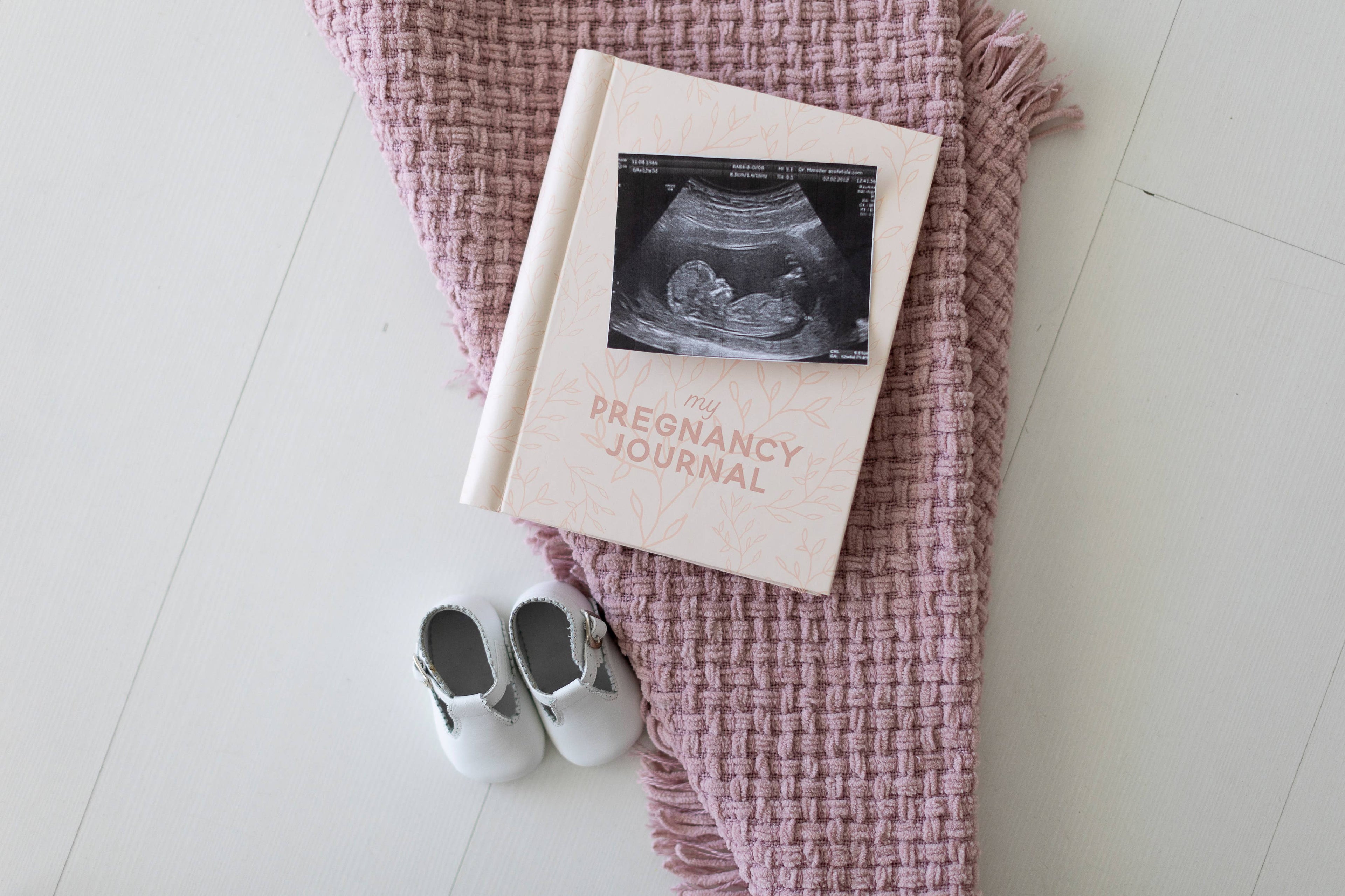 My Pregnancy Keepsake Journal