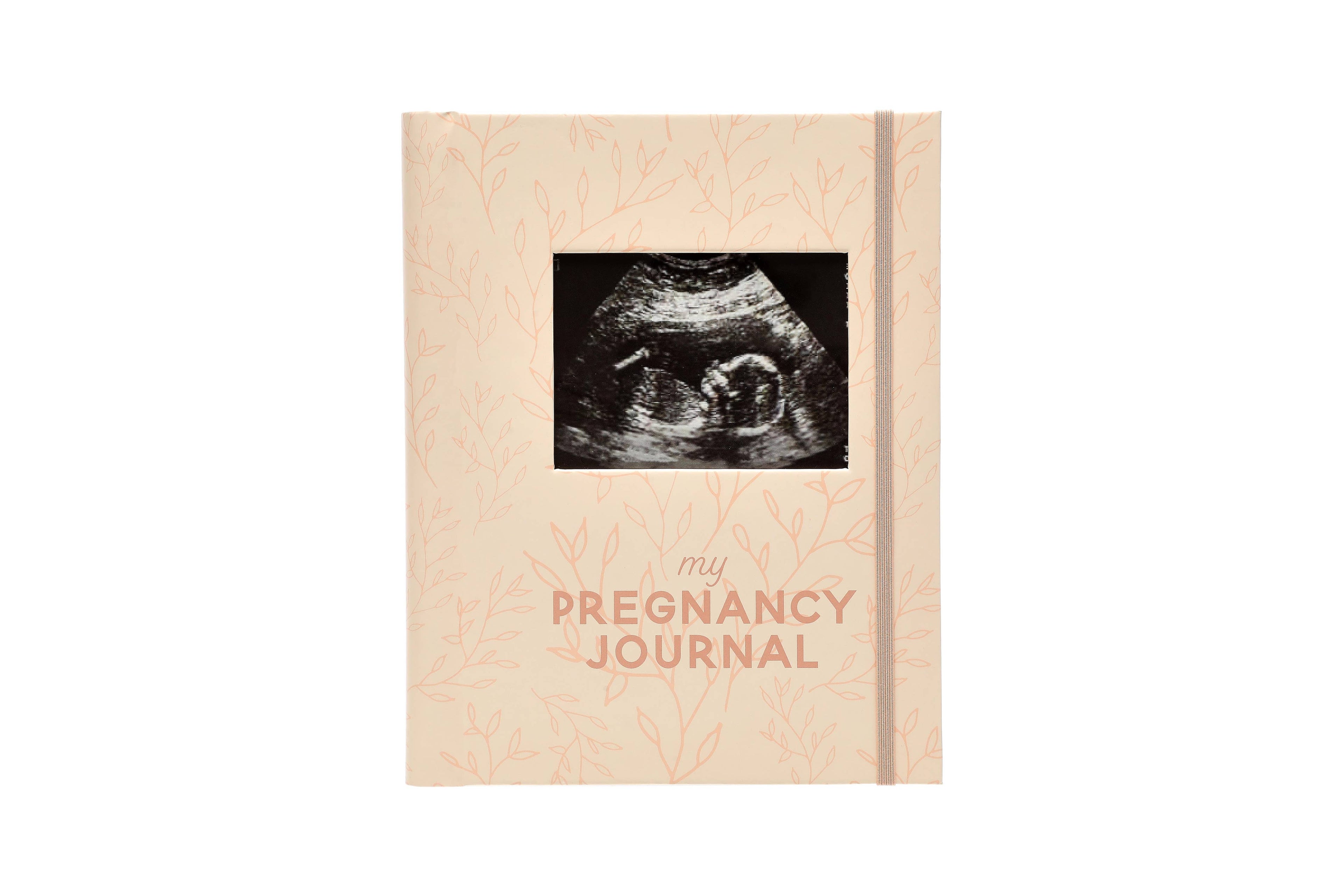 My Pregnancy Keepsake Journal